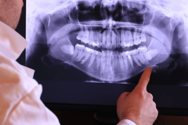 Best Pediatric Emergency Dentist in Mayville, NY